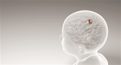 天顺注册：首例脑机接口设备人体移植完成